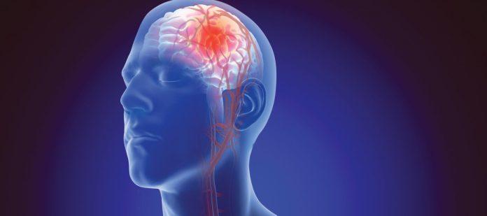 Brain Aneurysm Treatment Market
