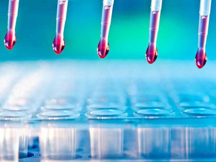 Singleplex Immunoassay Market