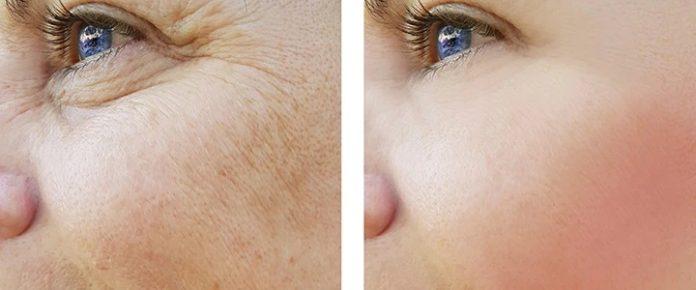 Skin Rejuvenation Treatment