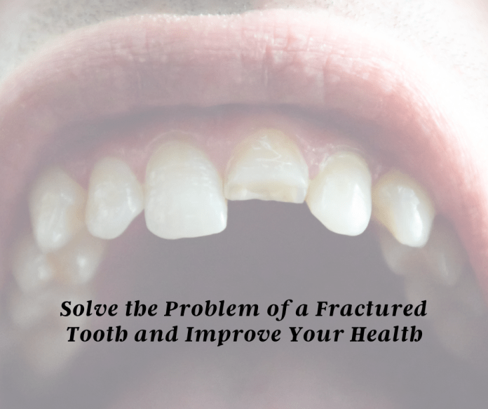 Fractured Tooth
