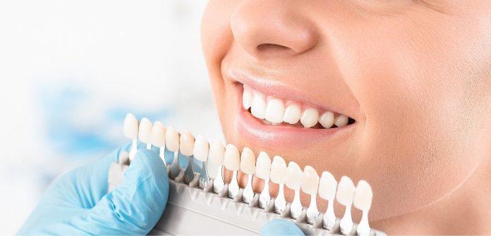 teeth whitening near me