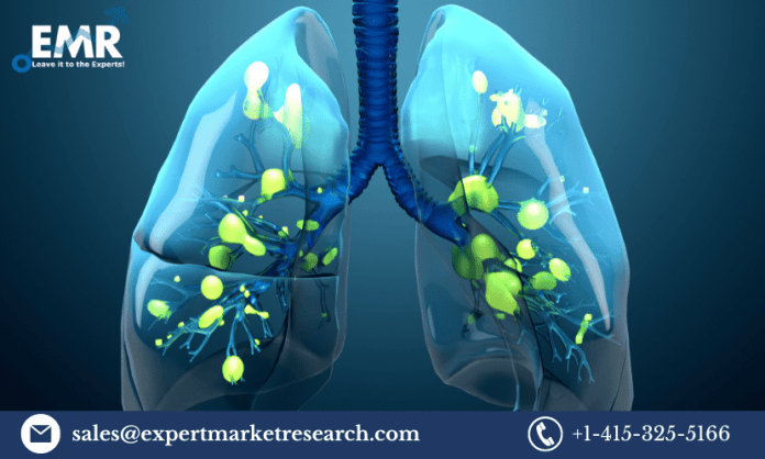 Acute Respiratory Syndrome Treatment Market