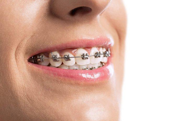 orthodontist rochdale