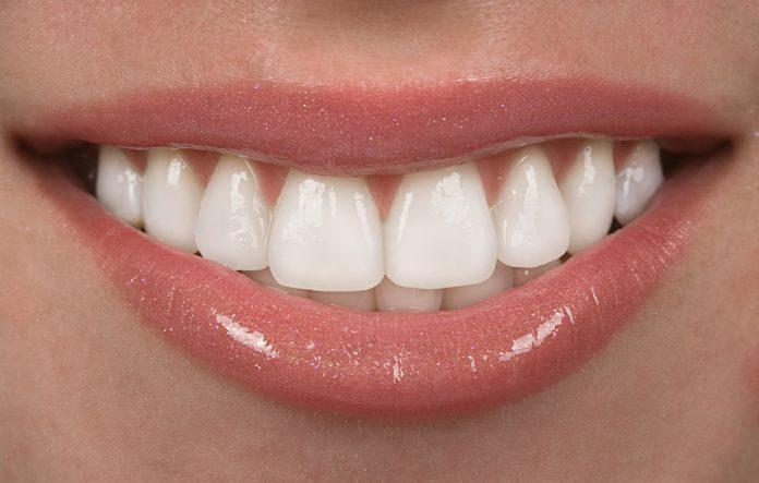 teeth whitening near me