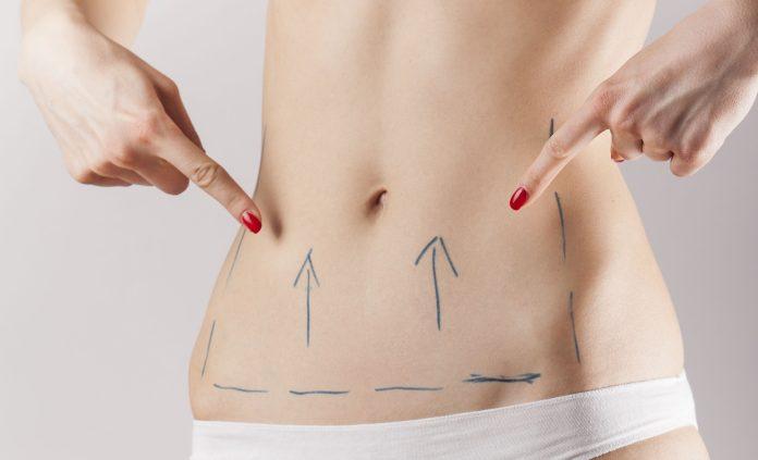 Pros of tummy tucker and lipoplasty surgery