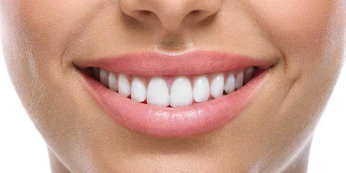 cosmetic dental bonding near me