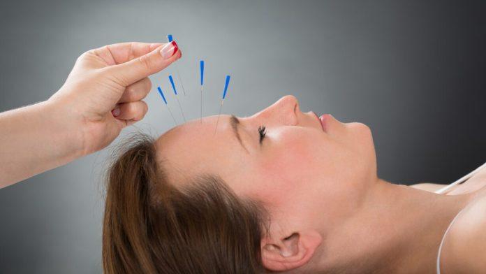 Acupuncture Ridgefield CT