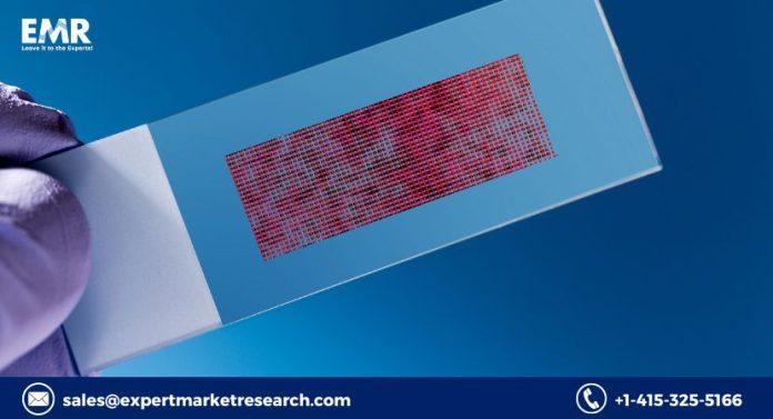 Biochips Based In-vitro Diagnostics Market