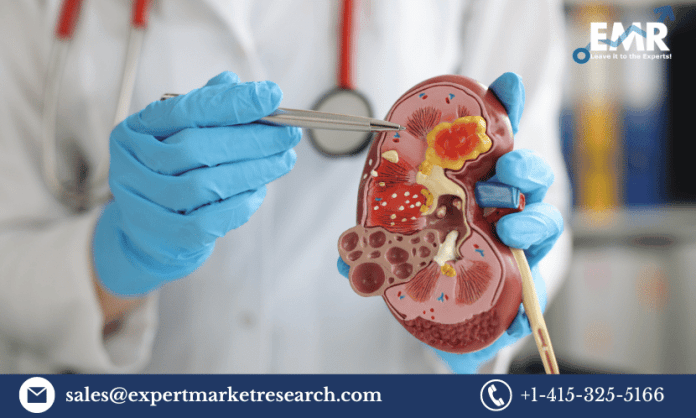 Gaucher’s Disease Treatment Market