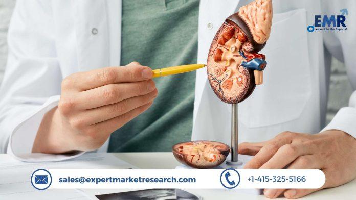 Kidney Stone Management Market Share