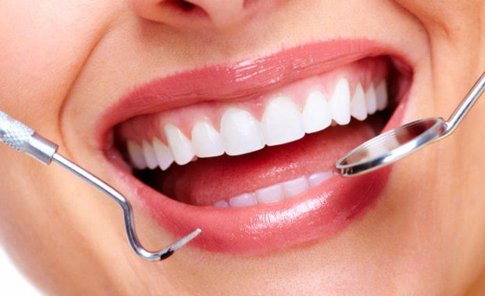 best at home teeth whitening