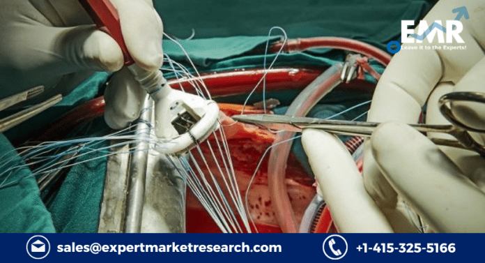 Aortic Valve Replacement Market Size