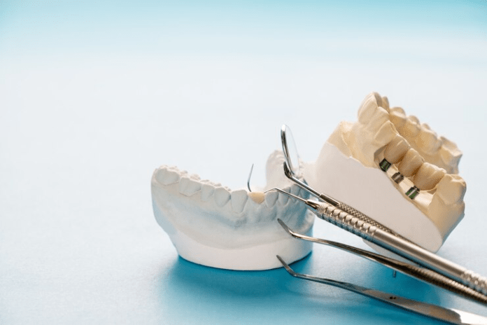 dental crowns brandon fl