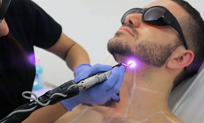 laser hair removal in Abu Dhabi