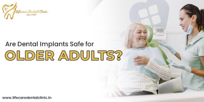 Are-Dental-Implants-Safe-for-Older-Adults