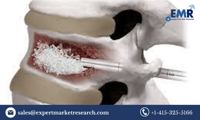 Bone Cement Market