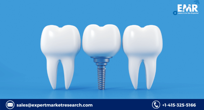 Dental Implant Abutment Systems Market