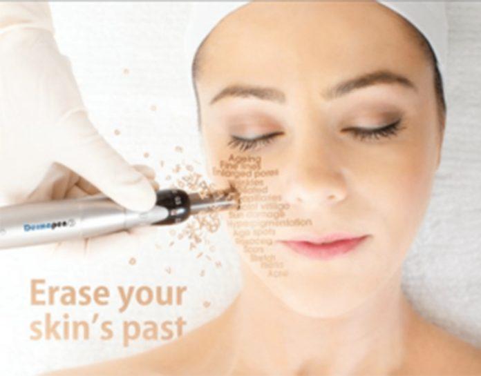 microneedling ottawa