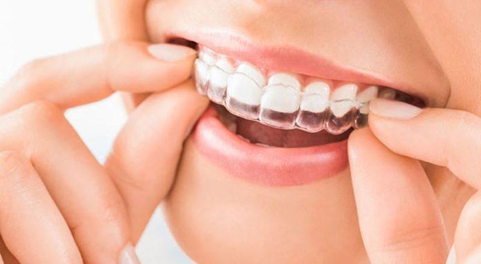 invisalign near me