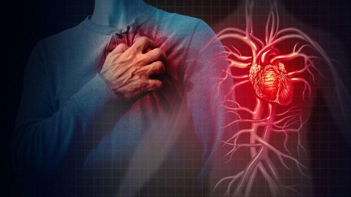 Best Cardiologist in Islamabad