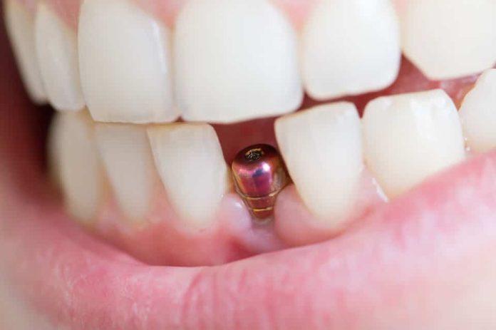 heights dental