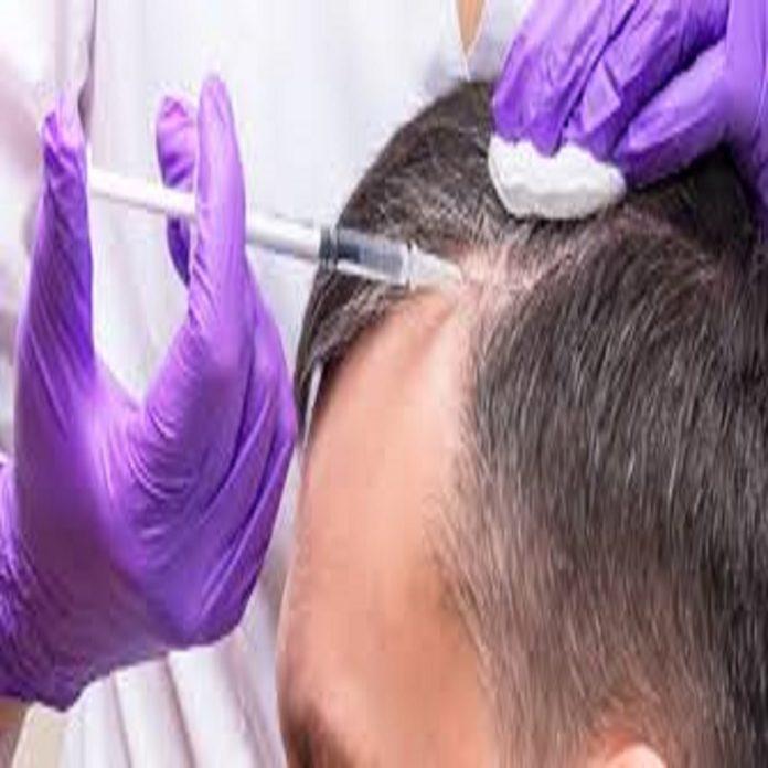 Acell PRP treatment for hair loss in Dubai