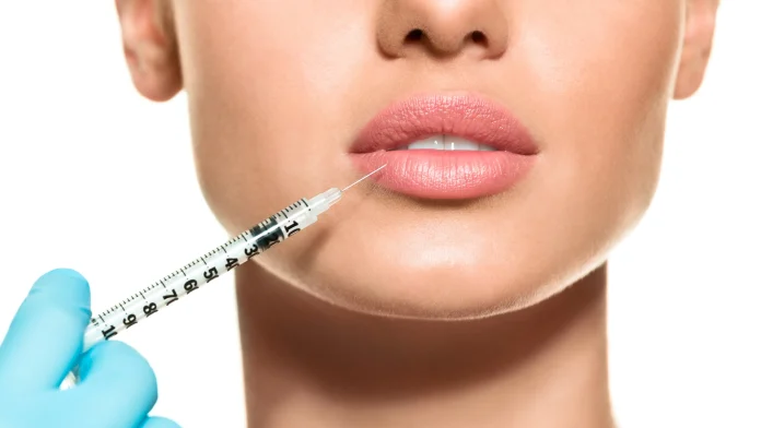 lip filler injections in Dubai