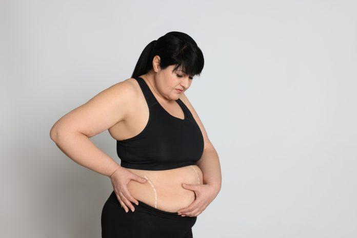 Stubborn Stomach Fat? What Can You Expect from a Tummy Tuck?