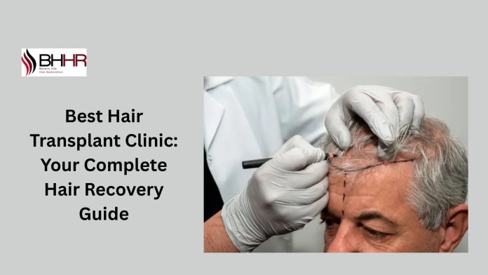 Best Hair Transplant Clinic